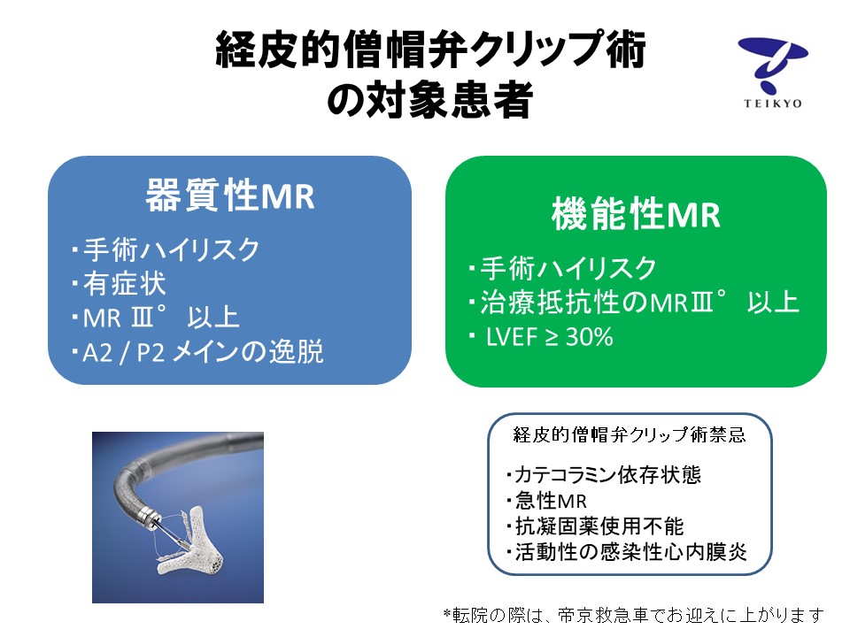 経皮的僧帽弁クリップ術を開始しました 帝京大学医学部附属病院 循環器内科